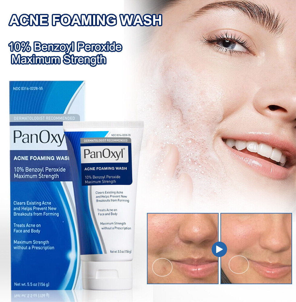 PanOxyl Acne Foaming Wash 10% Benzoyl Peroxide 5
