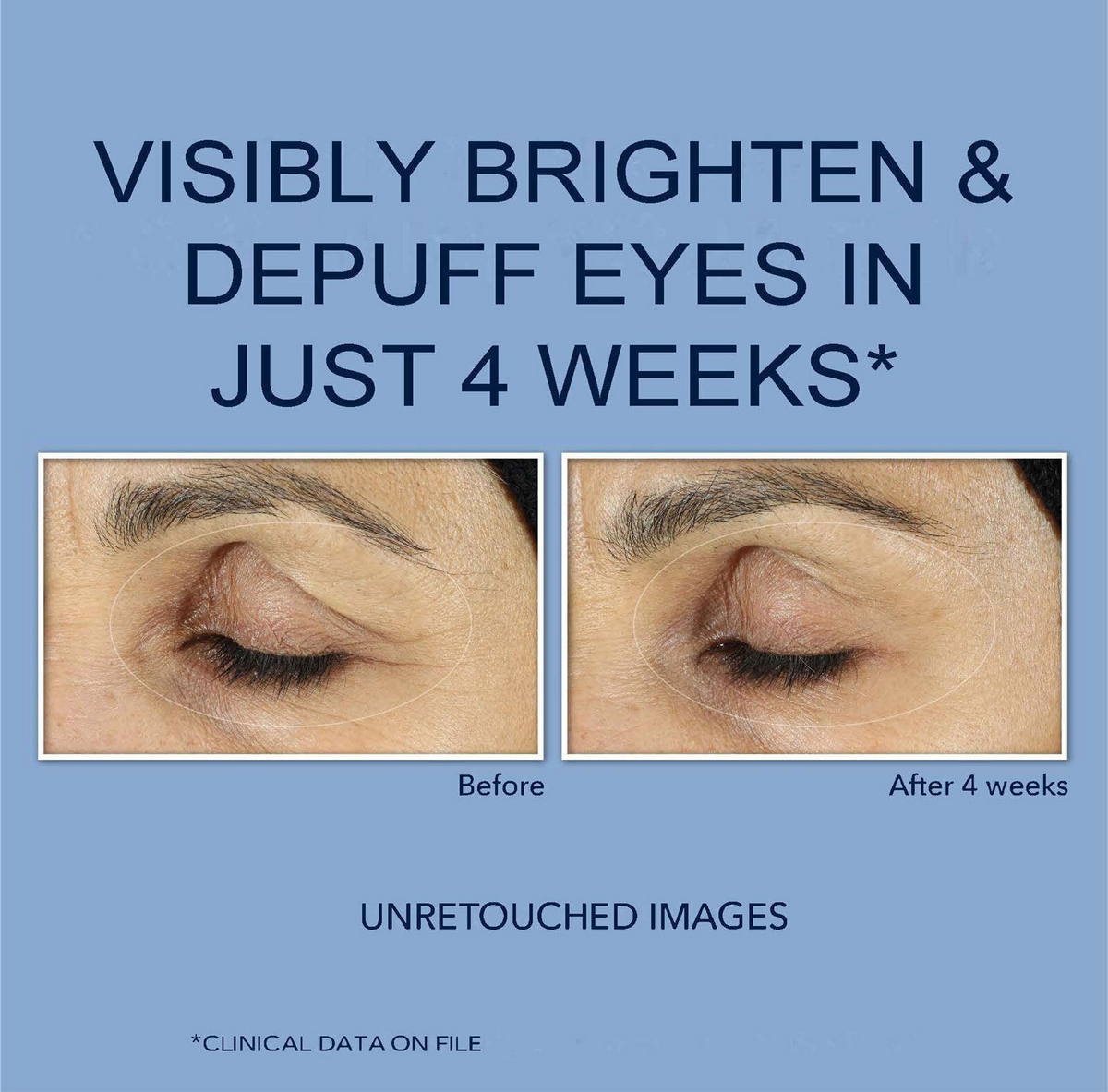 RoC Retinol Correxion Eye Cream with retinol