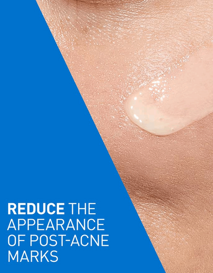 CeraVe Retinol Serum for Post-Acne Marks and Skin Texture | Pore Refining, Resurfacing, Brightening Facial Serum with Retinol and Niacinamide